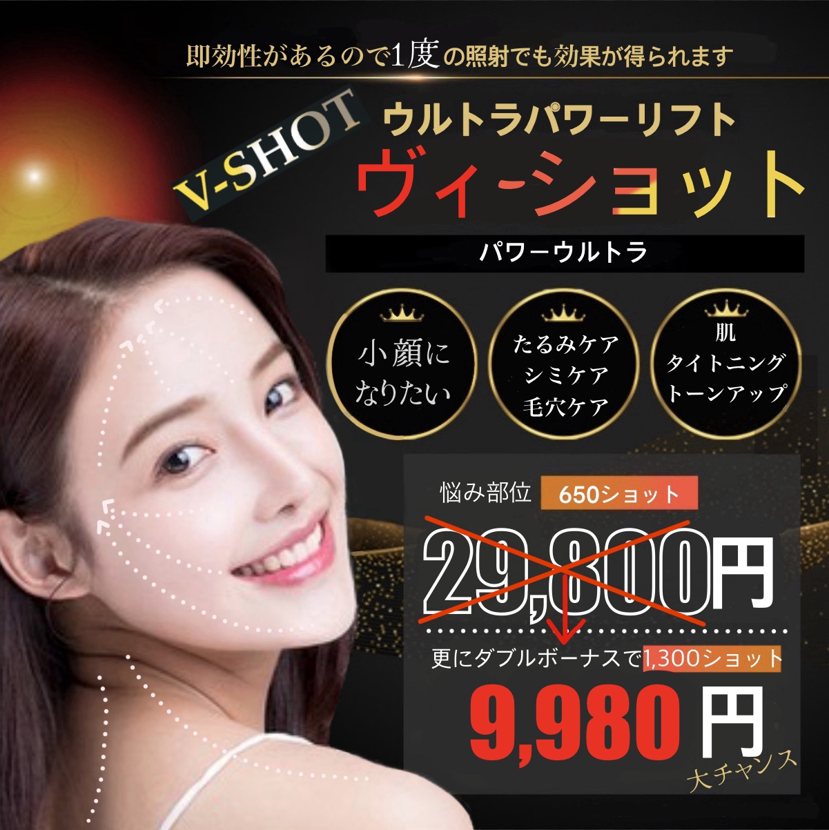 V-SHOT